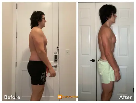Conrad, before and after, third angle.